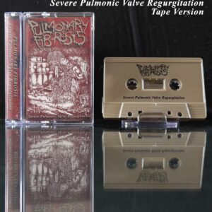 Tape